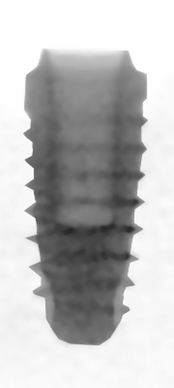 Perioseal main image