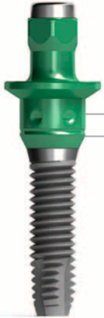 Hexagono Externo Classic Cilindrico main image