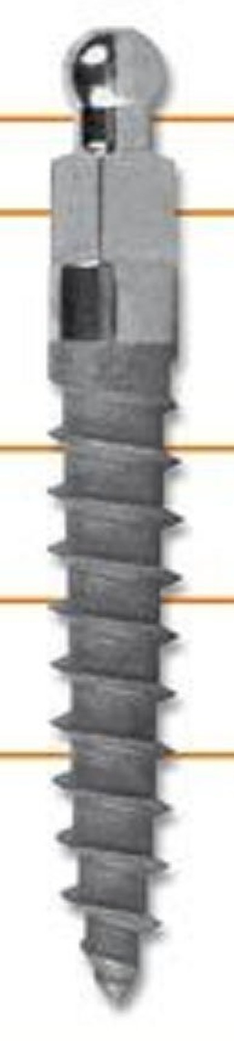 MDE main image