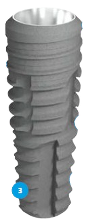 Bone Level main image