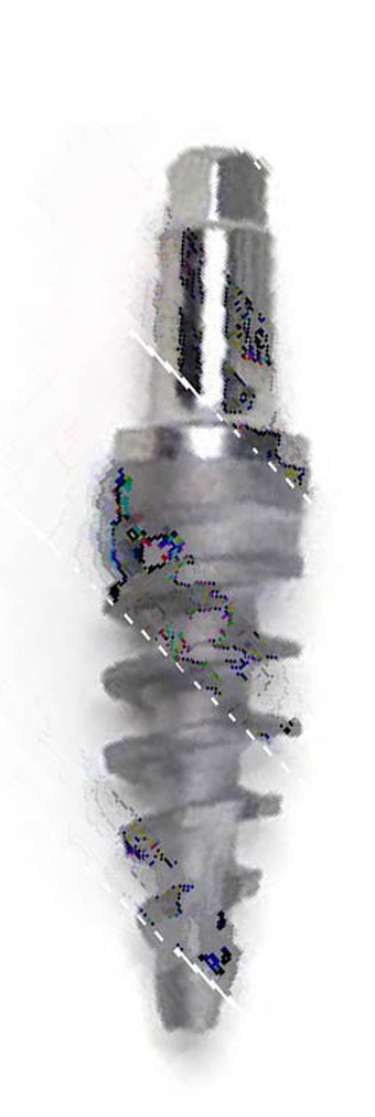 StableDent Post Implant main image