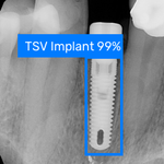 dental-implant-identification.png