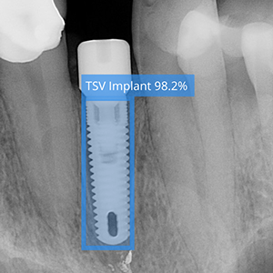 newimplant.png