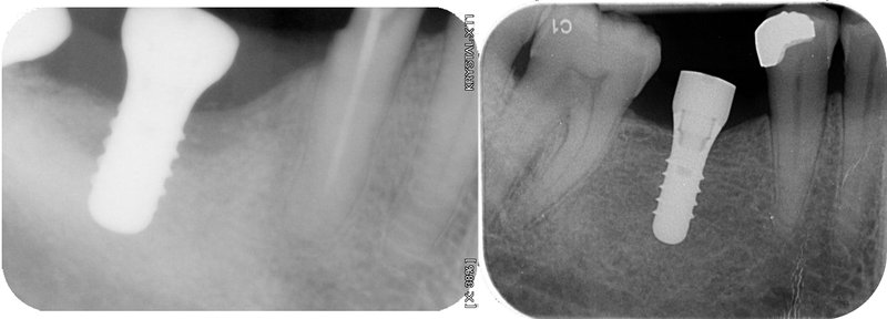 radiographs.jpg