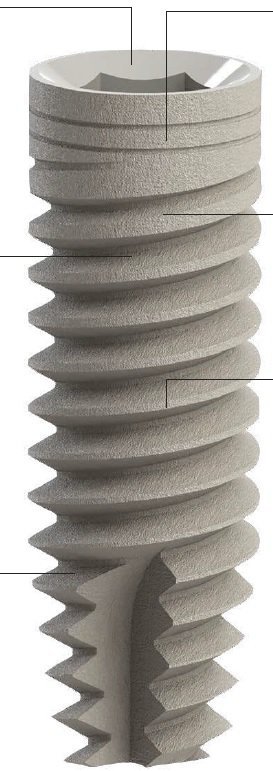 INSPIRAL MB main image