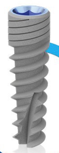 SDI Spiral Implant main image