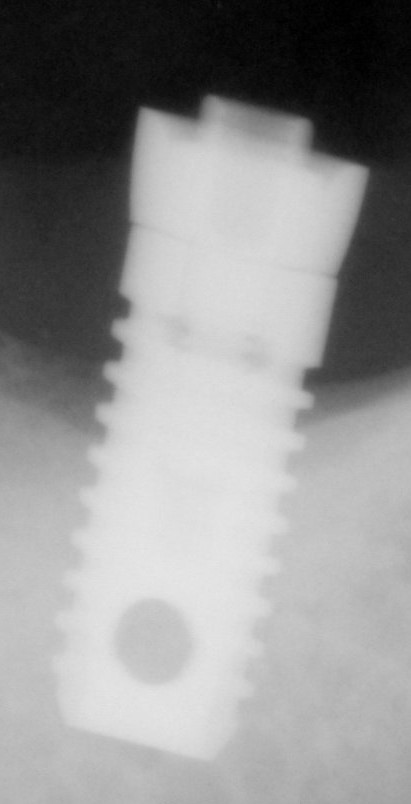 Ciny (with hole) main image