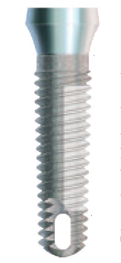 AdVent main image