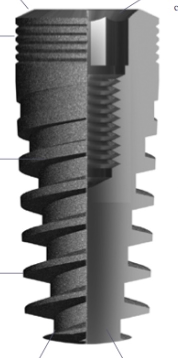 Spiral main image