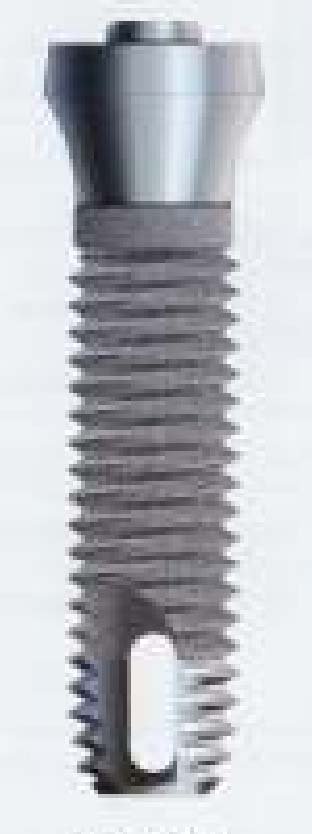 Screw-Vent (Flared Head) main image