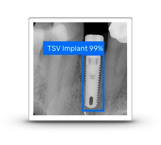 dental implant identification AI-based